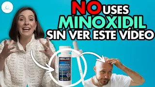 🔴 DERMATOLOGA te EXPLICA como APLICARTE MINOXIDIL ¿Efectos secundarios, shedding? Dra. Pilar Ochoa