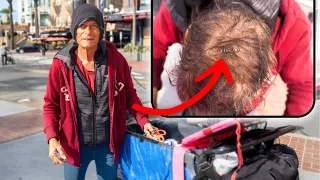 Transgender Homeless Woman Attacked Shows Staples in Her Head