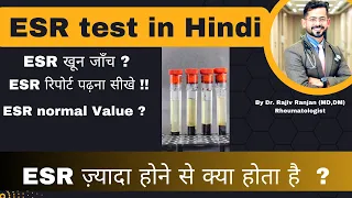 समझे ESR टेस्ट को ? | ESR से कौन ही बीमारी पता चलता है ? | ESR Blood test