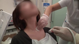 Thyroid Fine-Needle Aspiration and Smearing Techniques