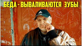 У Саши Ключа беда - Выпадают зубы!