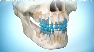 Eruption normale dents permanentes-Normal eruption of permanent teeth