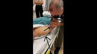 Shoulder Dislocation  and  Reduction Maneuver