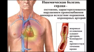 заболевания сердца wpw синдром