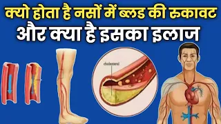 क्यो होता है?नसों में ब्लड की रुकावट और क्या है इसका इलाज|health solution