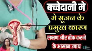 Bulky🤰Uterus.Uterus Me Sujan Ke Karan Lakshan aur upay.बच्चेदानी की सूजन कैसे ठीक करें.Dr.Babita