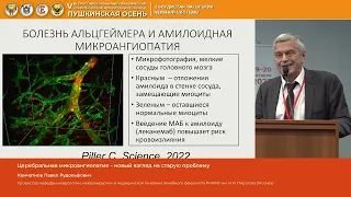 Камчатнов Павел Рудольфович Церебральная микроангиопатия – новый взгляд на старую проблему