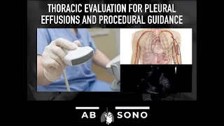 Thoracic evaluation for pleural effusions and procedural guidance