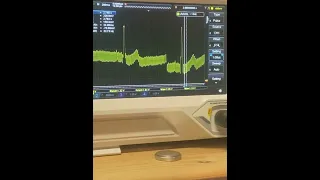 Measuring my ecg sinus rythm after heart failure with Rigol ds1054z oscilloscope.