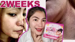 BRILLIANT SKIN REJUVENATING SET | IWASAN ANG Kati ,Hapdi ,PAMUMULA TIPS | HONEST REVIEW! NO TO SUNOG