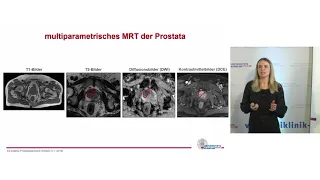 Diagnostik und Therapie beim Prostatakarzinom |  Prof. Dr. Cordula Jilg