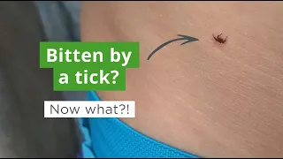 How to Remove a Tick | What To Do if You Get Bitten by a Tick