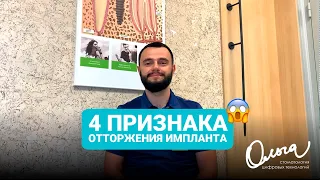 4 ПРИЗНАКА ОТТОРЖЕНИЯ ИМПЛАНТА