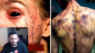 8 People Who Gained REAL SUPERPOWERS After An Accident REACTION!