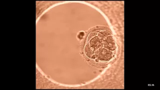 Развитие эмбриона с момента оплодотворения in vitro и до 5 6 дня развития реальное видео 1