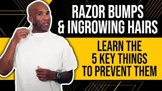 Razor Bumps & Ingrowing Hairs : Learn The 5 Key Things To Prevent Them (Esp 4 black people shaving)