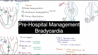 Symptomatic Bradycardia - Prehospital Management