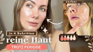 Perioden Pickel loswerden🩸 Meine effektive Methode 💆‍♀️