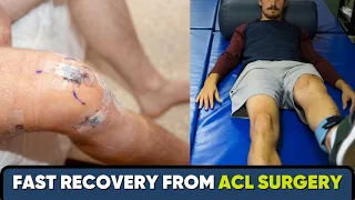 Fast recovery from ACL surgery-ACL सर्जरी से फ़ास्ट रिकवरी- English Subtitles- Dr Pankaj Walecha