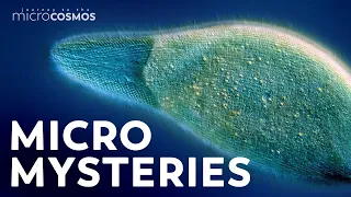 Unsolved Mysteries of the Microcosmos