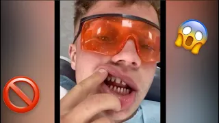 Orthodontist Reacts! Dangerous Tiktok Teeth Trend! #Shorts