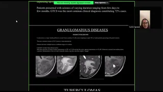 Surbhi Agrawal | MRI evaluation of epilepsy with clinical correlation #mriteachingcourse