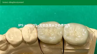 【歯科技工】IPS:emaxプレスセラミックの作り方How to make pressed ceramics emax Dental technician at work
