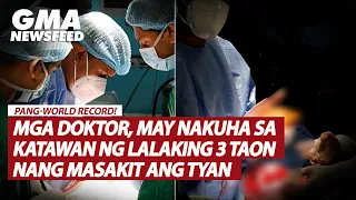 Mga doktor, may nakuha sa katawan ng lalaking 3 taon nang masakit ang tiyan | GMA News Feed