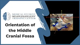 Orientation of the Middle Cranial Fossa - Neurosurgery Training Center