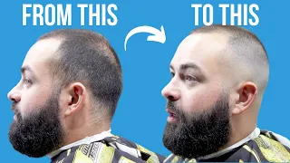 HOW TO FADE THINNING HAIR | MULTIPLE HAIR TEXTURES