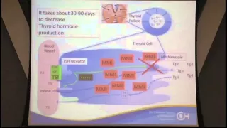 Medical Management of Graves' Disease in Children and Adolescents