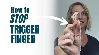 How to Stop Trigger Finger CATCHING and POPPING (TRY THIS!)
