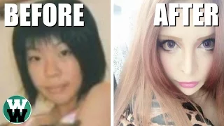 10 Most Extreme Plastic Surgeries You Won't Believe!