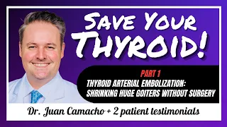 (Episode #79 PART 1) Thyroid Arterial Embolization in SARASOTA: Dr. Juan Camacho