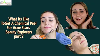 What Its Like To Get A Chemical Peel For Acne Scars  Beauty Explorers part 2