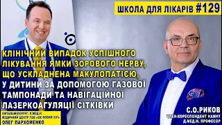 ОФТАЛЬМОЛОГІЯ. Клінічний випадок УСПІШНОГО Лікування ЯМКИ ЗОРОВОГО НЕРВУ що УСКЛАДНЕНА МАКУЛОПАТІЄЮ