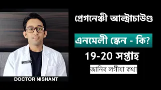 ANOMALY  SCAN  - এনমেলী স্কেন ( ASSAMESE ) | MOST IMPORTANT SCAN | DETAIL  | DOCTOR NISHANT