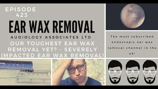 OUR TOUGHEST EAR WAX REMOVAL YET? - SEVERELY IMPACTED EAR WAX REMOVAL - EP423