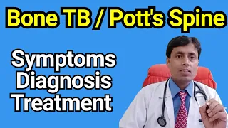 Bone TB Treatment // Spine TB treatment // Potts Spine treatment // Dr Sanjay Chest Specialist Patna