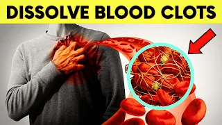 7 Everyday Foods That Naturally Dissolve Blood Clots