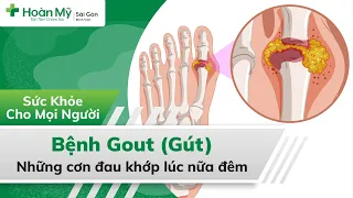 Bệnh Gout (Gút) | Gout là gì? Phát hiện sớm và Điều trị khỏi