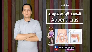 ازاى تعرف حالة التهاب الزائدة الدودية فى الطوارئ /appendicitis