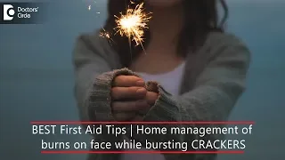 Know these first aid tips in case of burns on face while bursting crackers - Dr. Aruna Prasad