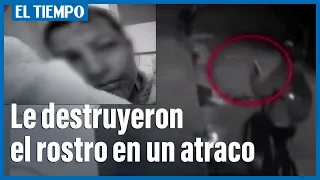 A mujer de 38 años, delincuentes le destruyeron el rostro en un atraco | El Tiempo