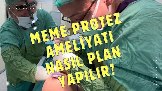 Meme Protez Ameliyatı Nasıl Plan Yapılır? Kas Altı, Kas Üstümü  Nasıl Karar Verilir  ?