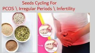 How To Cure PCOS | Seeds Cycling For Magical Results | Hormones imbalances | Dietitian Maryam