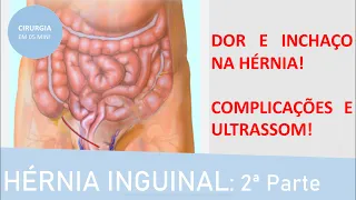 Sintomas da hérnia inguinal e as suas complicações! | Fernando Eyer