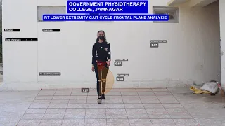 frontal plane gait analysis