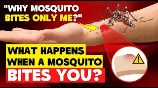 What happens when a mosquito bites you? Why mosquitoes bites me more than others? How mosquito works