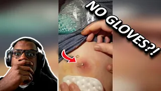 THE PIMPLE EXPLODED ALL OVER THE CEILING! 😱 | Popping Huge Blackheads and Pimple Popping
